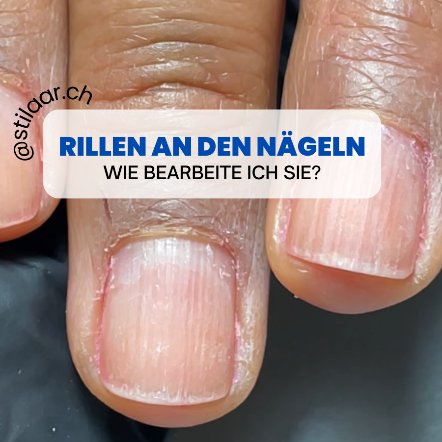 ideale lösung für nagelrillen.